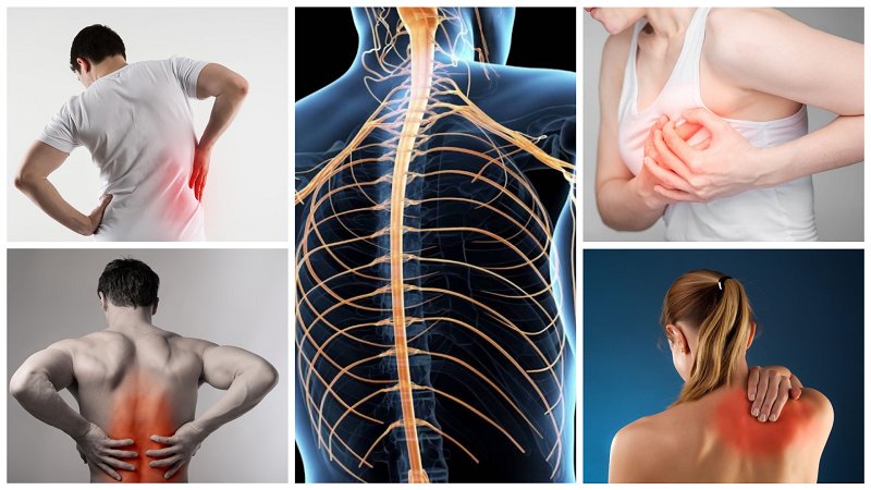 Як лікувати невралгію в домашніх умовах: поради, які дійсно допомагають